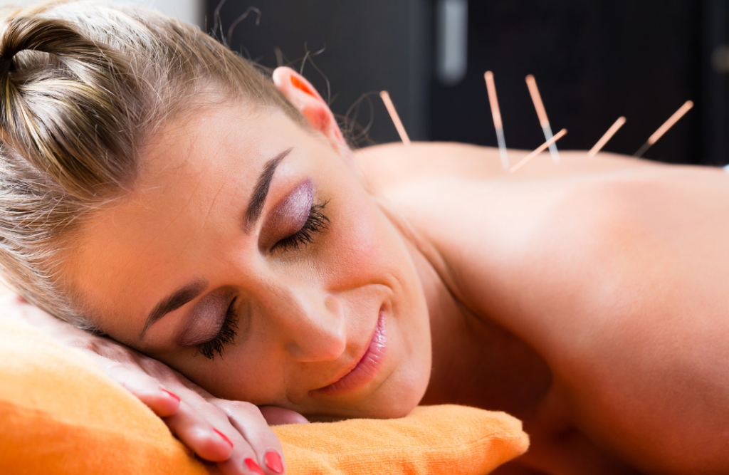 Dry Needling is performed on a patient’s muscle to relieve tension and support pain reduction